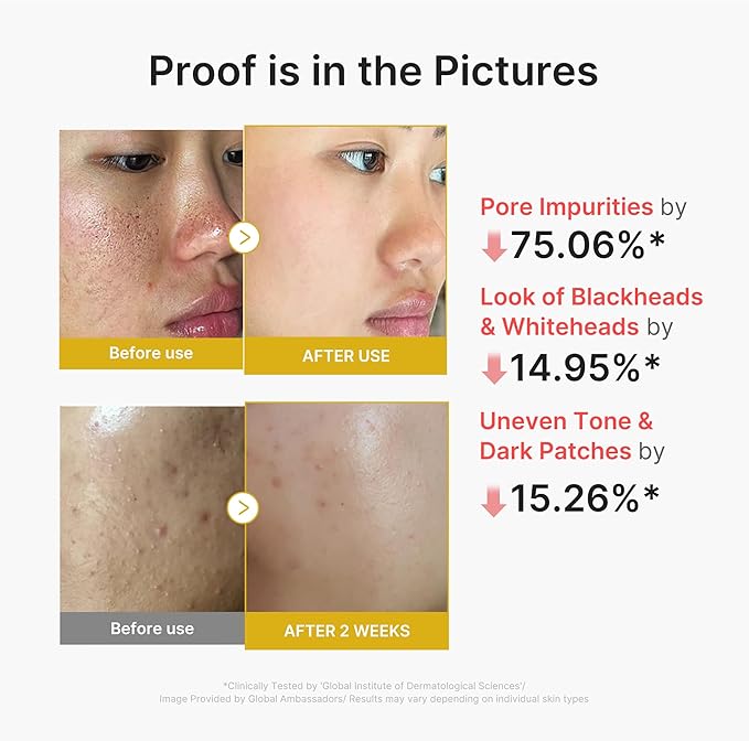 MEDICUBE KOJIC ACID TURMERIC BODY PEEL SHOT 80ML