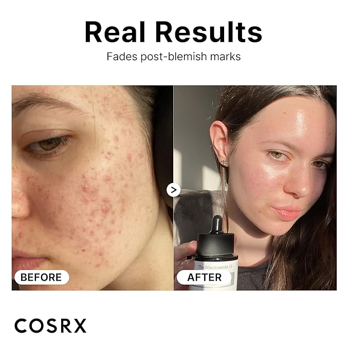 COSRX THE NIACINAMIDE 15٪؜ SERUM 20ML