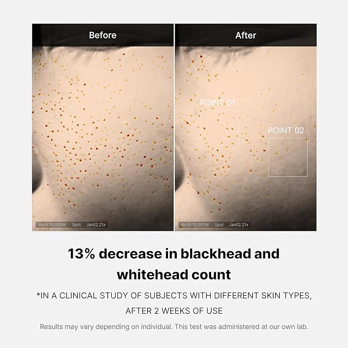 MEDICUBE ZERO PORE ONE DAY SERUM 30ML
