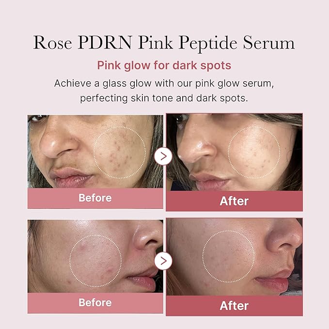 MEDICUBE PDRN PINK PEPTIDE SERUM 30ML