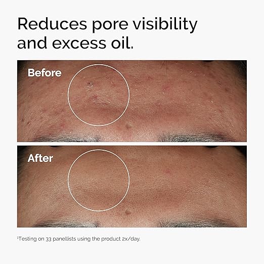 THE ORDINARY NIACINAMIDE 10% ZINC 1% THE ORDINARY 60ML (GRAND FORMAT)