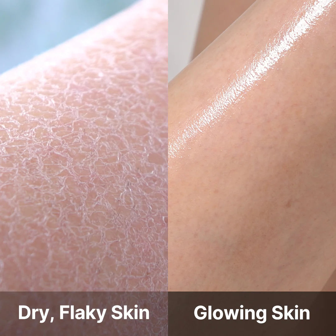 MEDICUBE RED ACNE BODY WASH AHA BHA PHA NIACINAMIDE 400G