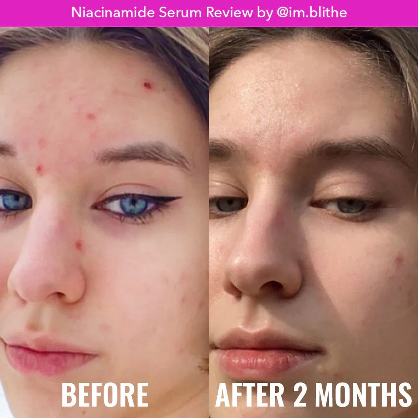 GOOD MOLECULES NIACINAMIDE SERUM - Premium  from DION - Just DA 3450! Shop now at DION
