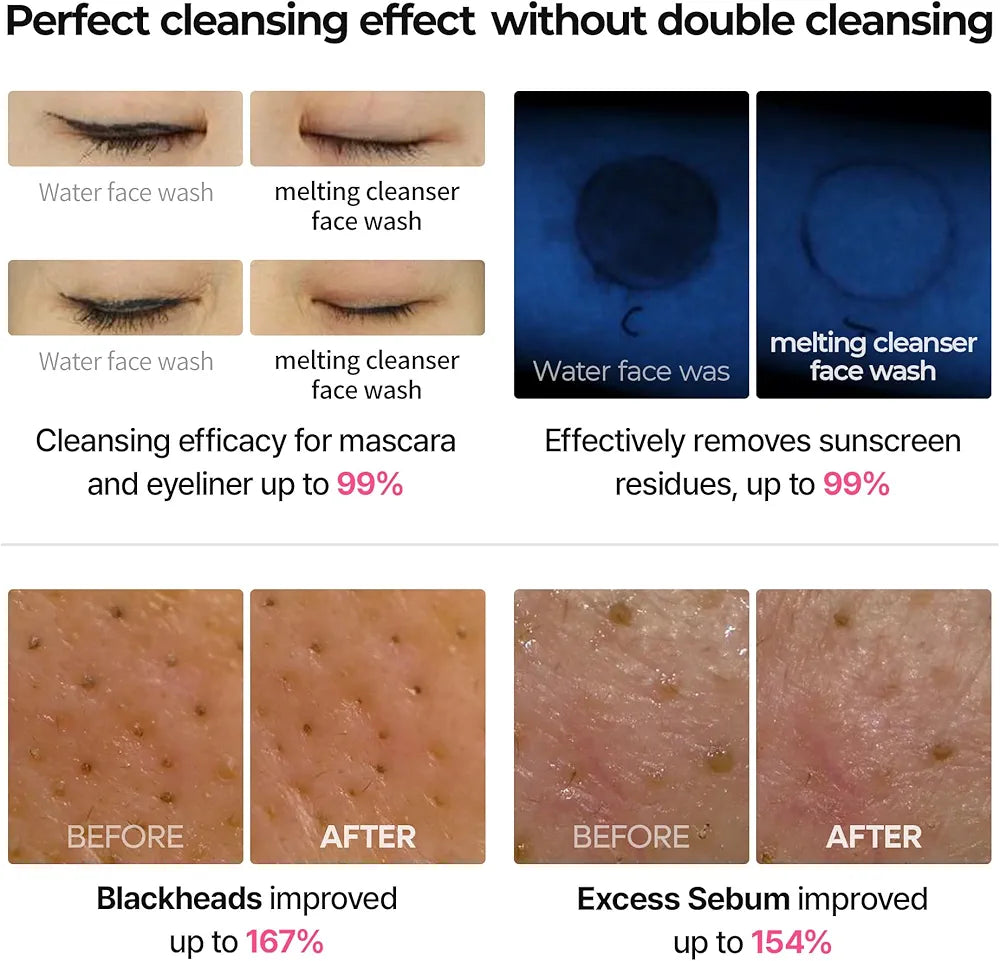 DR.MELAXIN BUBBLE FOAMING CLEANSING CALAMINE+ NIACINAMIDE 150ML