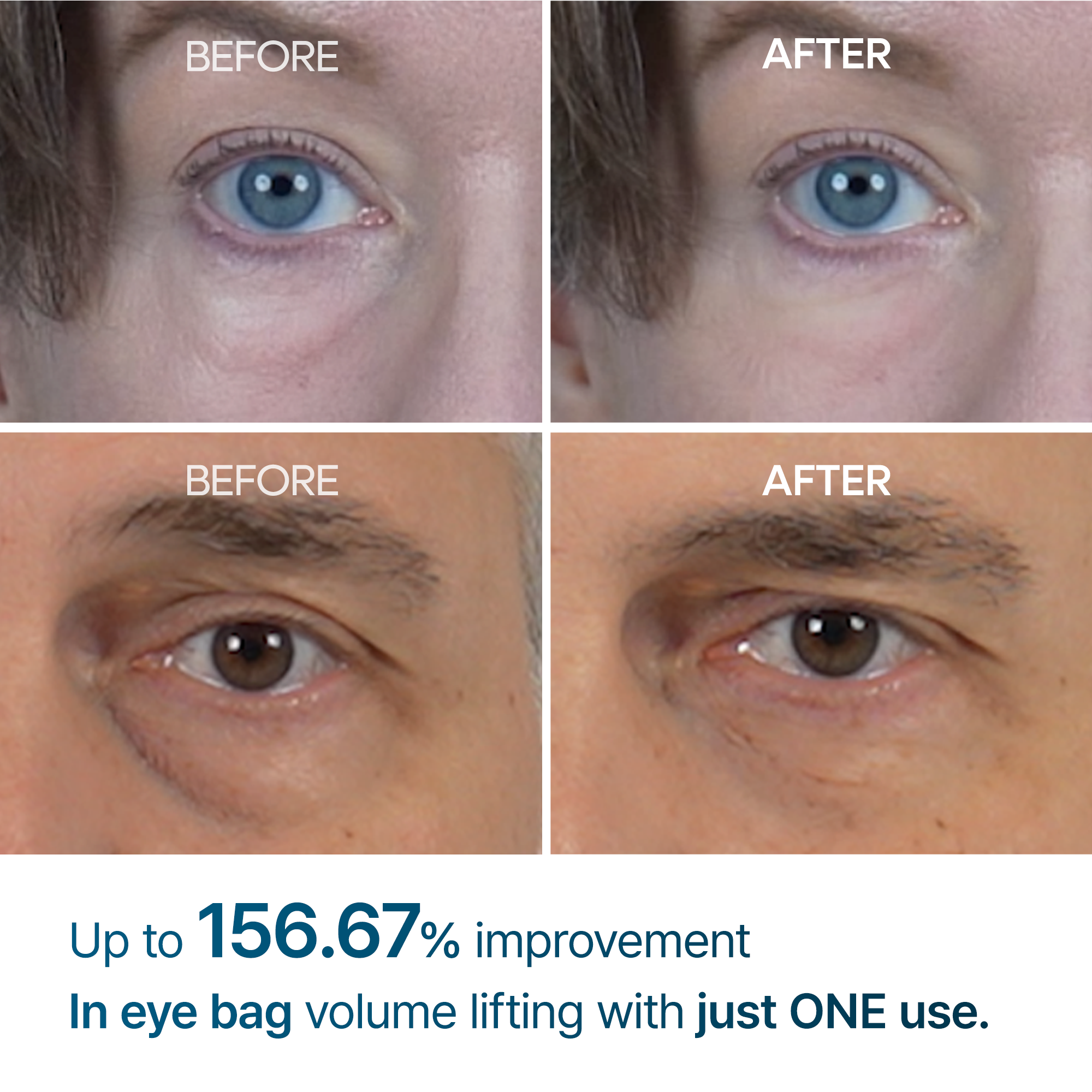 DR.MELAXIN RETINOL EYEBAG CREAM 10G