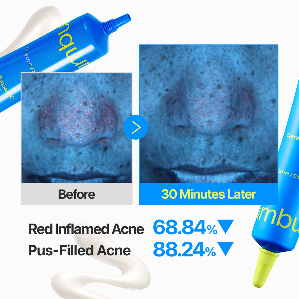 NUMBUZIN ZERO BLEMISH 3×SPOT CORRECTING CREAM 20ML