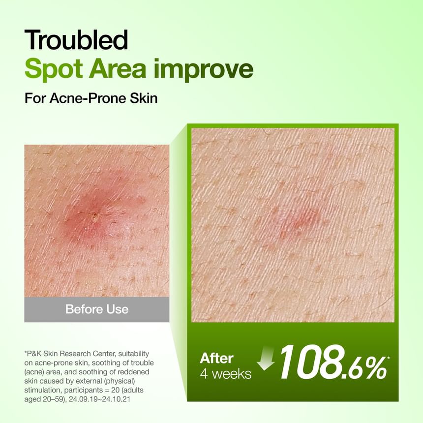 ANUA × KPOP DEMON HUNTERS AZELAIC ACID 10 HYALURON REDNESS SOOTHING SERUM 50ML