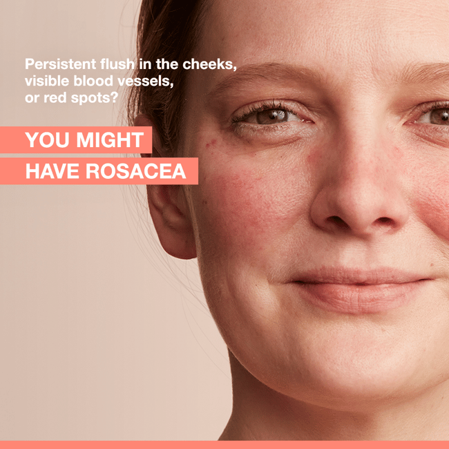 AVÈNE ANTIROUGEURS ROSAMED PEAUX SENSIBLES 30ML