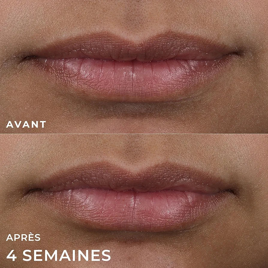 ROC DERM CORRECTION LIP VOLUMIZER REPLUMPING TREATMENT  10ML