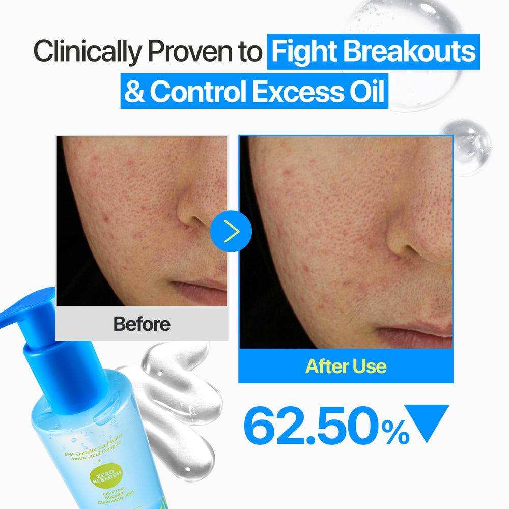 NUMBUZIN ZERO BLEMISH OIL-FREE MICELLAR CLEANSING JELLY 200 ML