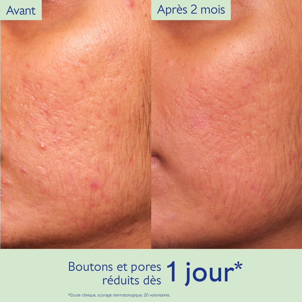 CAUDALIE VINOPURE SÉRUM SALICYLIC ANTI-IMPERFECTION 30ML