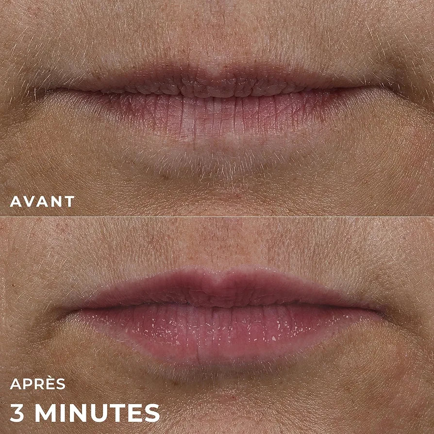 ROC DERM CORRECTION LIP VOLUMIZER REPLUMPING TREATMENT  10ML
