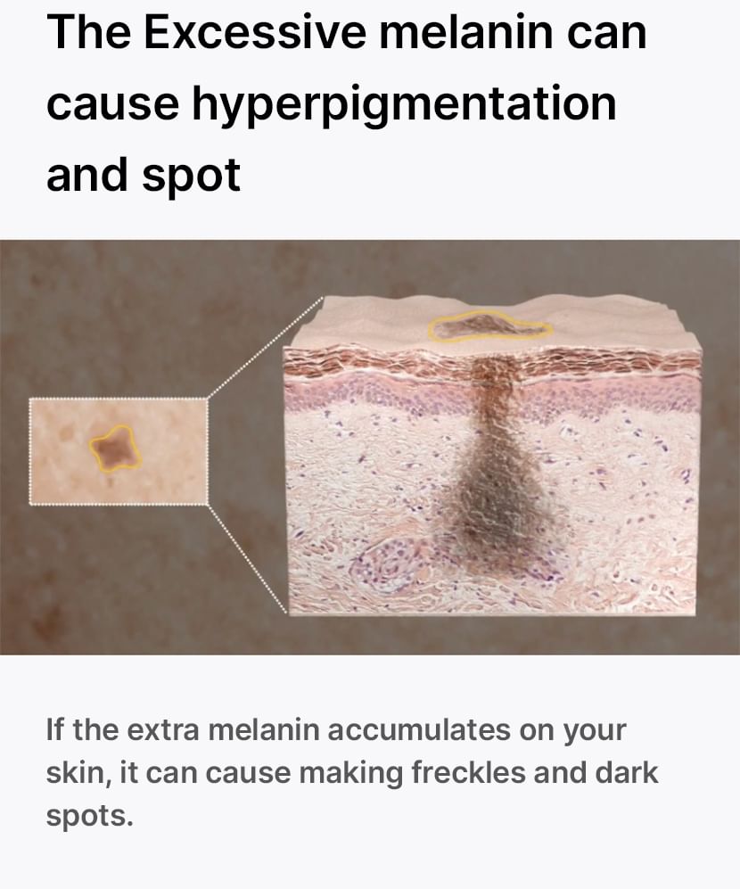 CELIMAX PORE+DARK SPOT KIT 3 PCS