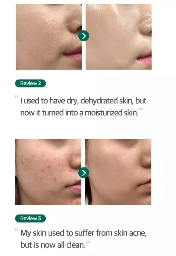 SOME BY MI AHA BHA PHA REAL CICA 92 % COOL CALMING GEL APAISANT 300 ML