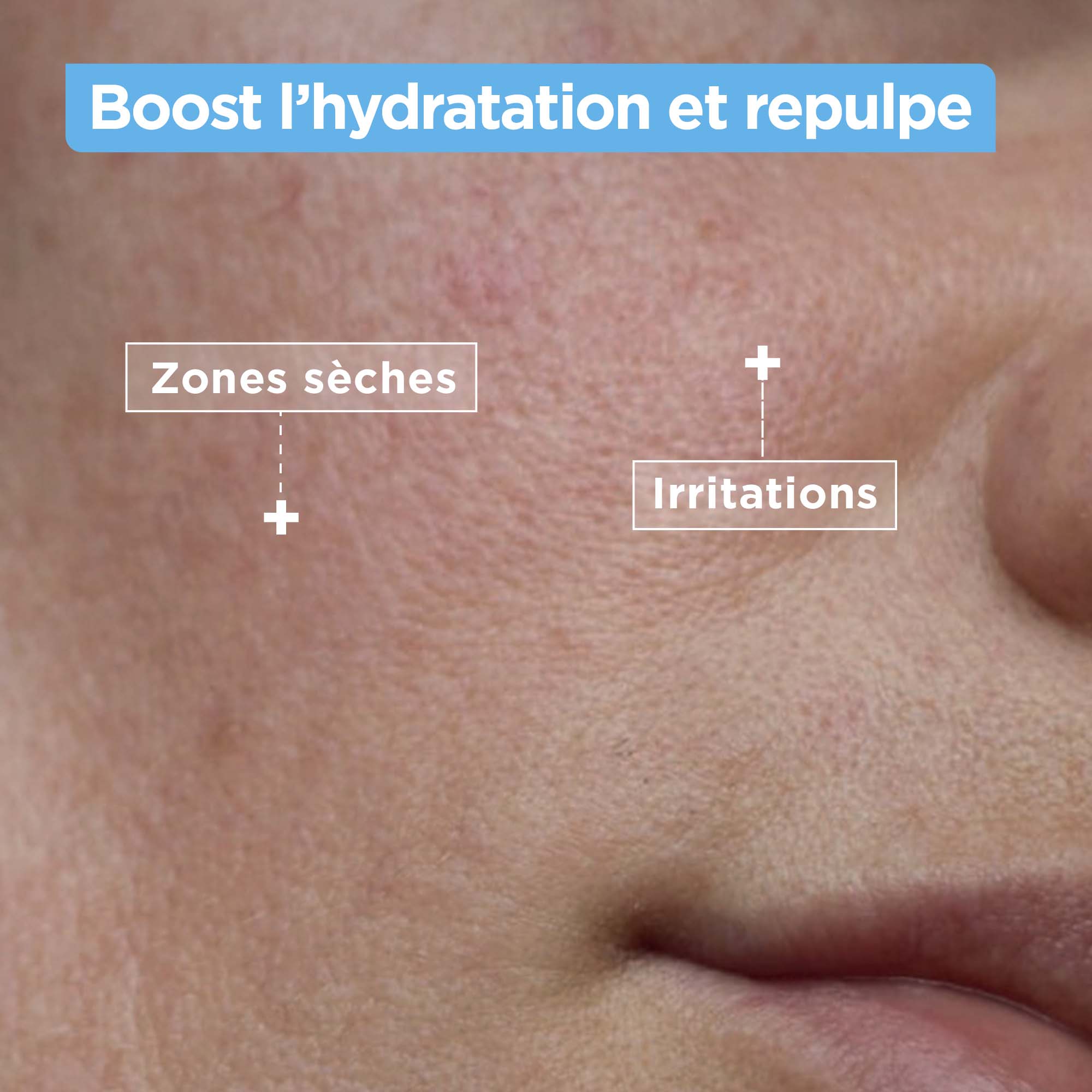 MIXA NETTOYANT CONFORT ANTI-SÉCHERESSE À L'ACIDE HYALURONIQUE 150ML